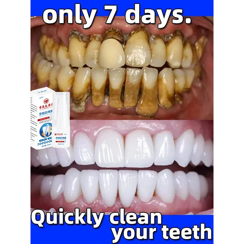 Dental Calculus Remover Teeth Whitening Spray Fresh Breath Care Toothpaste Cleaning Oral Hygiene Removal Halitosis Plaque Stains