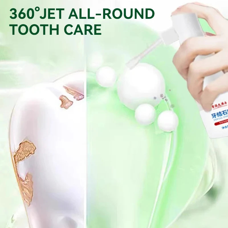 Dental Calculus Remover Teeth Whitening Spray Fresh Breath Care Toothpaste Cleaning Oral Hygiene Removal Halitosis Plaque Stains