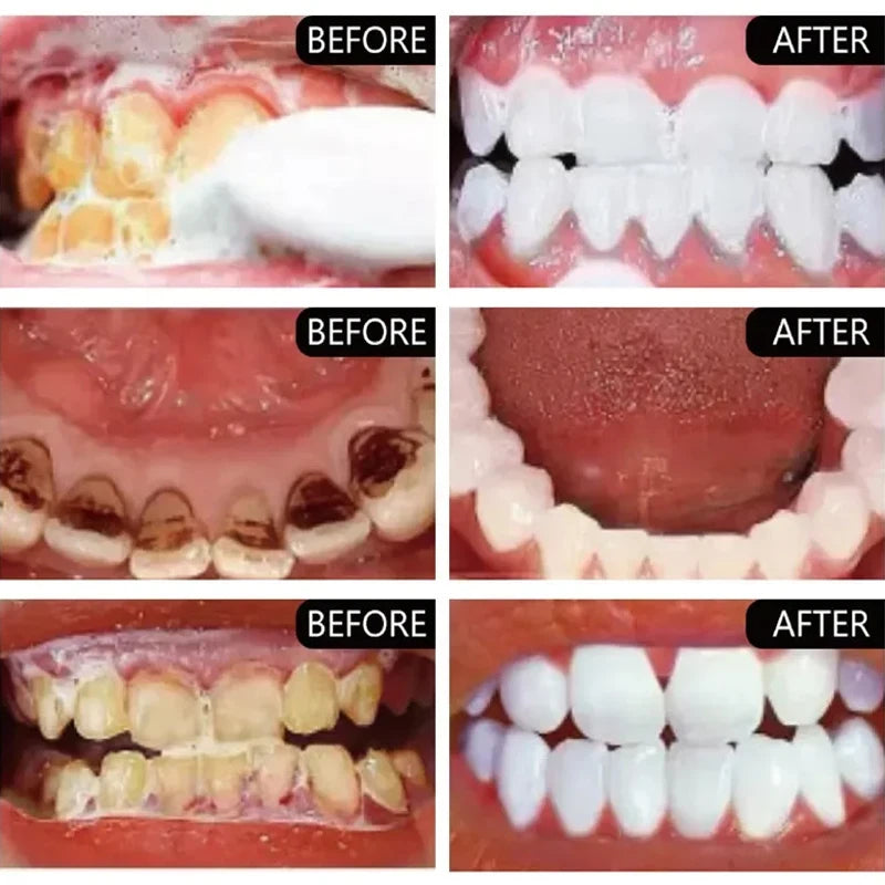 Smile solutions toothpaste.