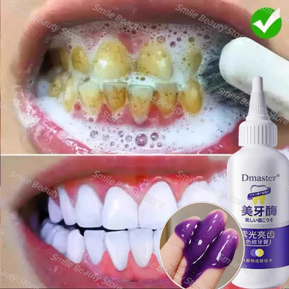 V34 Teeth Whitening Enzyme Toothpaste Remove Plaque Stains Mousse Cleaning Oral Hygiene Dental Tools Fresh Breath Beauty Health